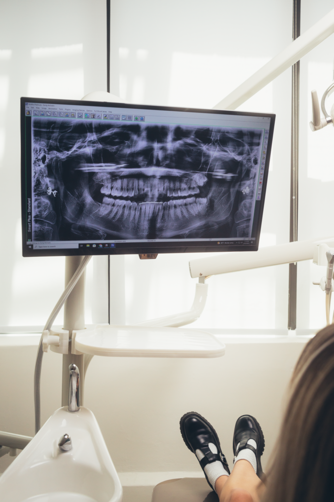 Panoramic dental X-ray displayed on a monitor during a dental exam, showing full teeth and jaw structure for diagnosis and treatment planning.