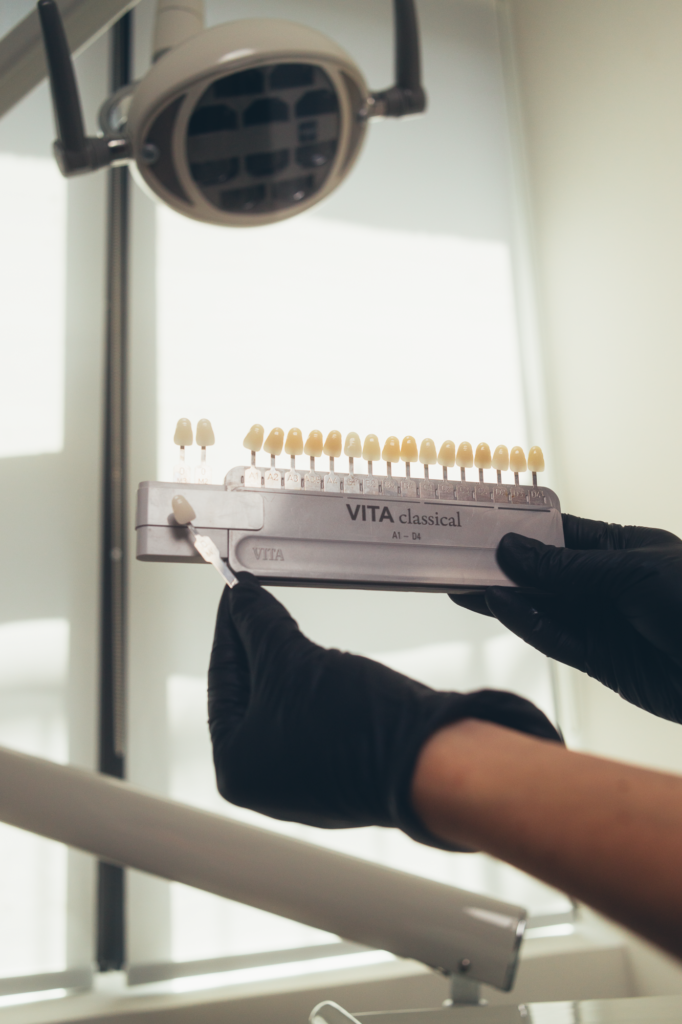 Close-up of a dental professional using a VITA classical tooth shade guide to match natural tooth color, highlighting precision cosmetic dentistry, teeth whitening planning, and personalized smile design in a modern dental clinic.