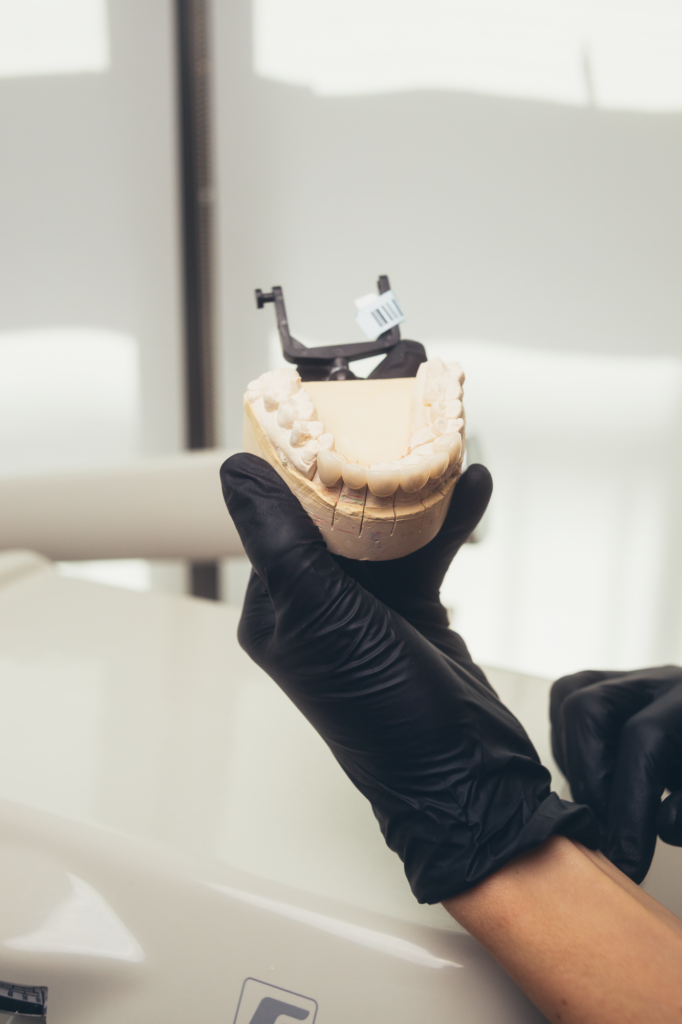 Gloved hand holding dental mold model at SMILELOUNGE in Brooklyn, NY
